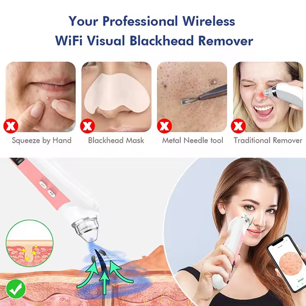 Вакуумный Очиститель пор, устр – обзор и цена Pore Vacuum