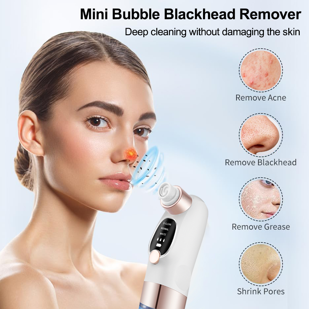 Электрический вакуумный очисти – обзор и цена Pore Vacuum