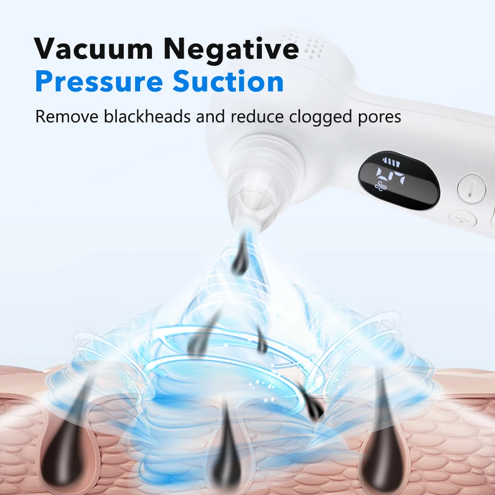 Вакуумный очиститель пор от че – обзор и цена Pore Vacuum